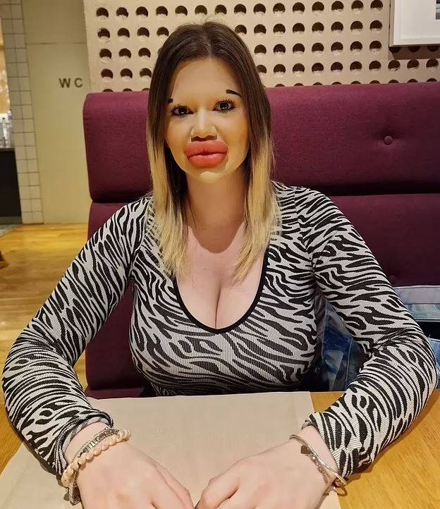 Dudakları patladı patlayacak ama Andrea kararlı! 1