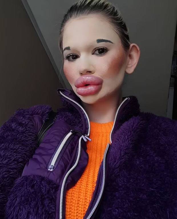 Dudakları patladı patlayacak ama Andrea kararlı! 5