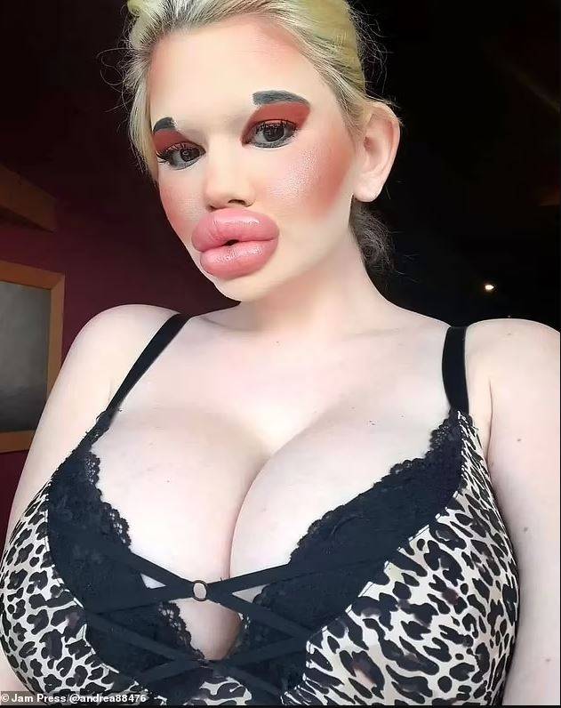 Dudakları patladı patlayacak ama Andrea kararlı! 4