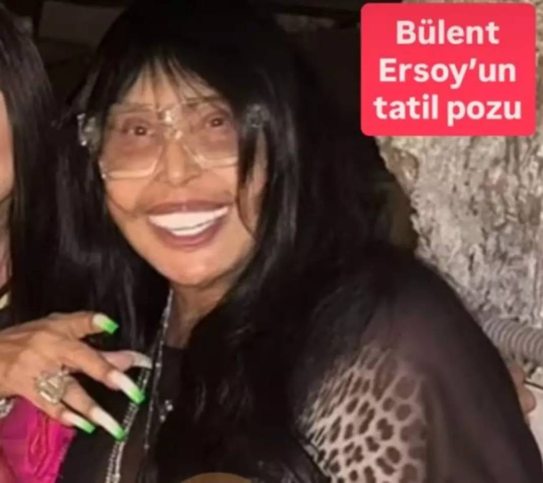 Bülent Ersoy'un makyajsız hali olay oldu: Görenler gözlerine inanamadı! 6