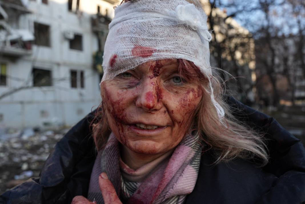 Ukrayna’da dehşetin fotoğrafları 1