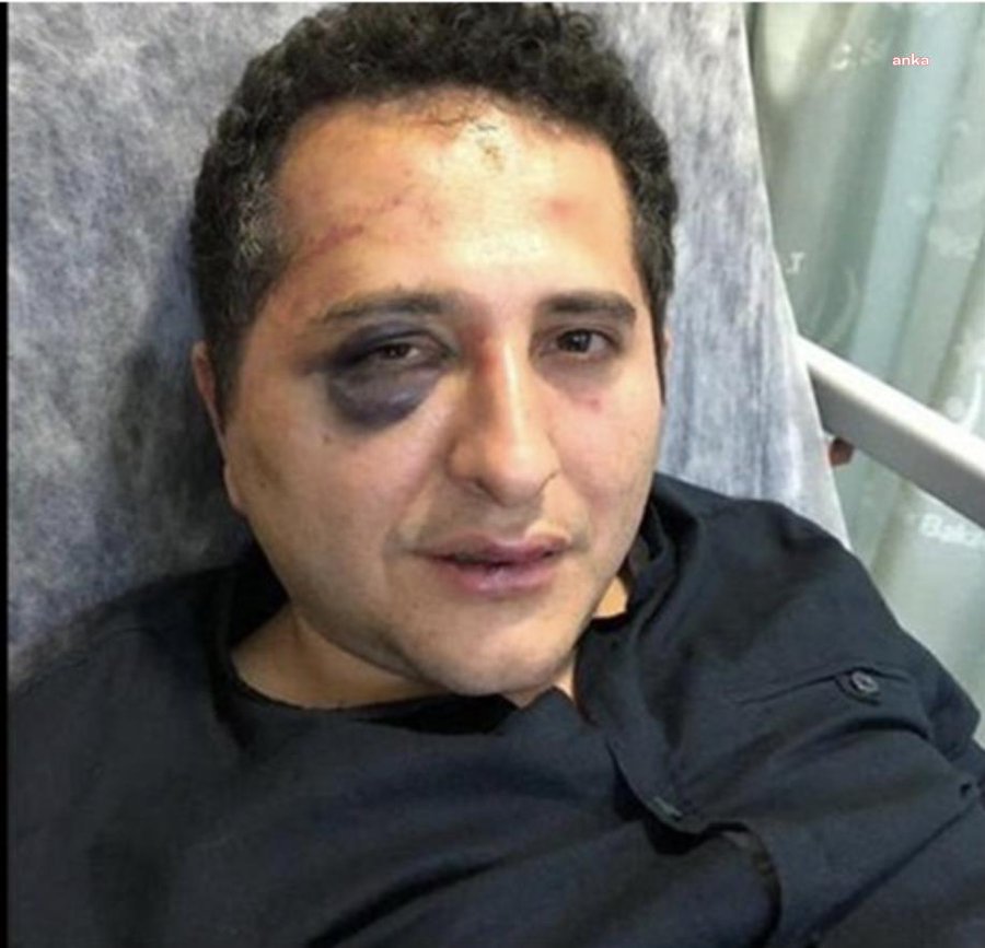 TBB, 'Avukata darp' soruşturması için harekete geçti: 'Cumhurbaşkanlığı korumaları hakkında kamu davası talebi'