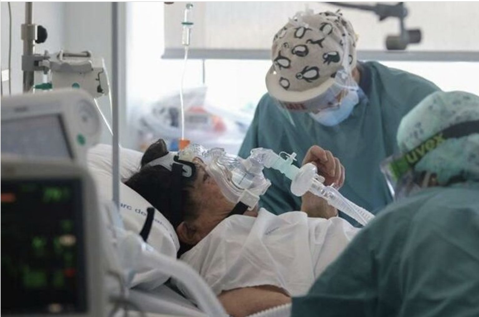 Röntgen sonuçlarını paylaştı: Delta varyantının uzun vadeli etkileri...