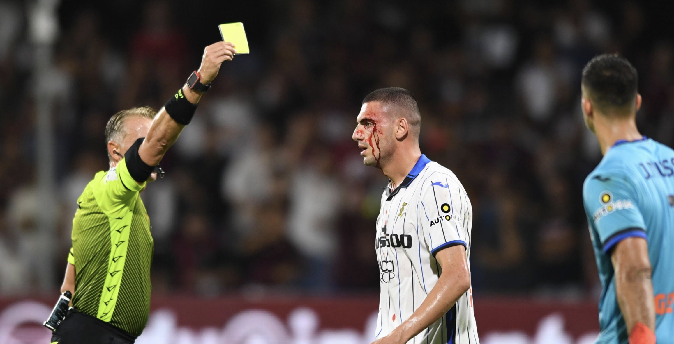 Merih Demiral'ın kaşı açıldığı maçta Atalanta galip