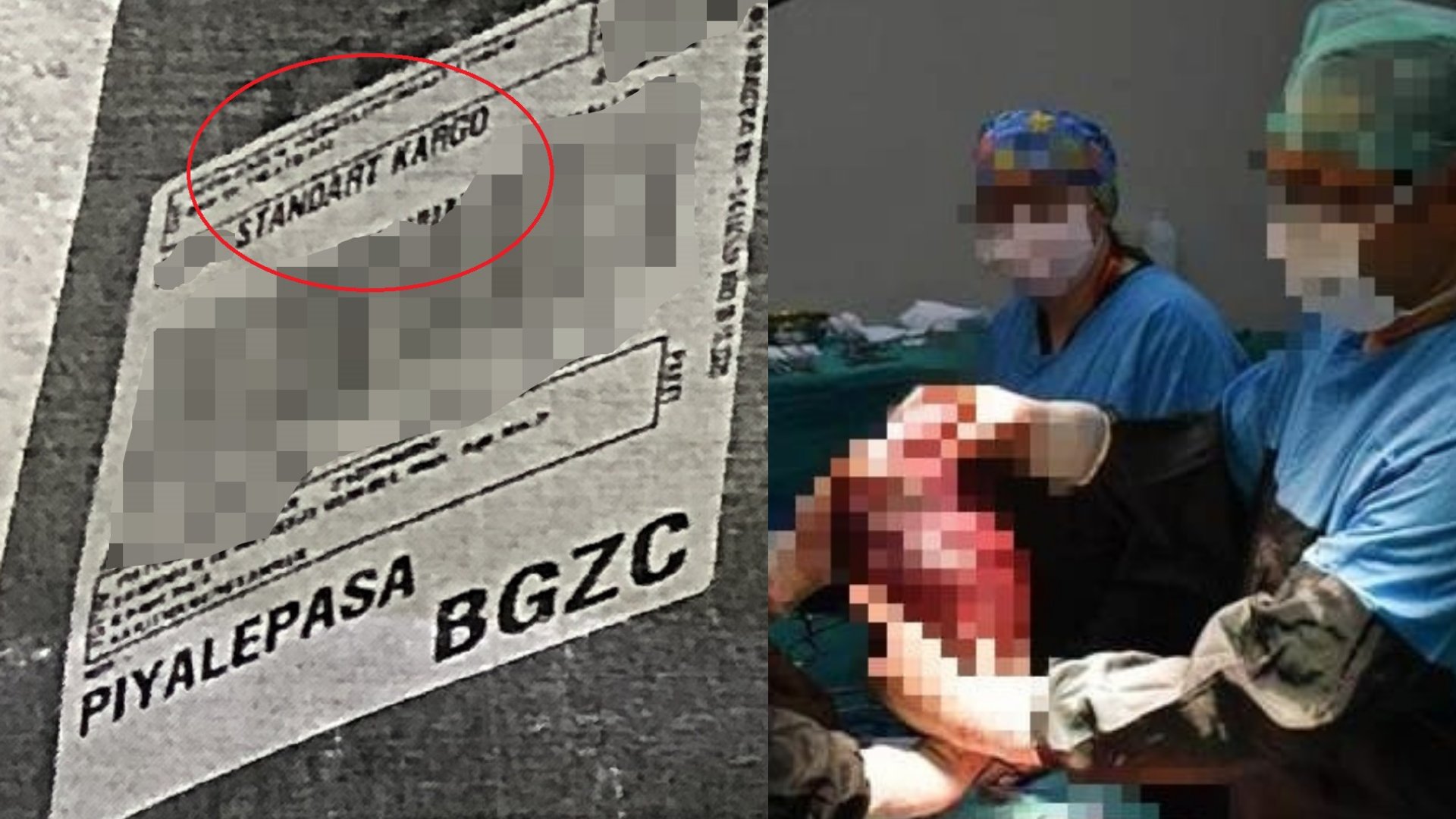 Dikkat dikkat: Kargoda bir adet insan dalağı kaybolmuştur