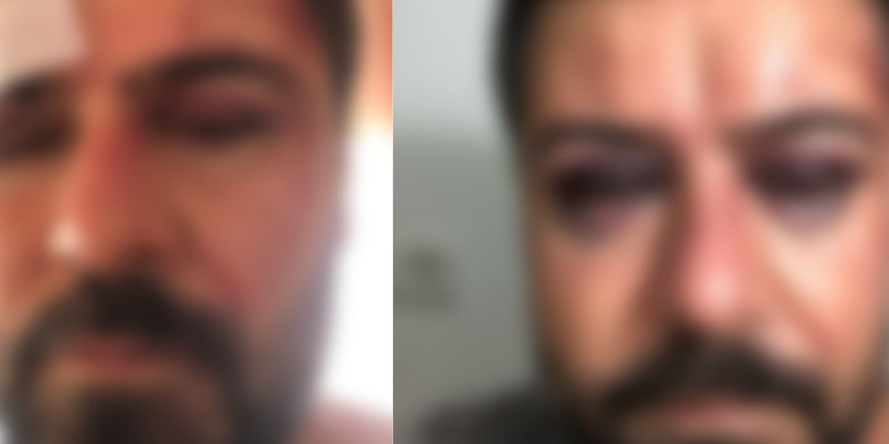 MHP'li Anamur Belediye Başkanı'na 'talebini ileten' vatandaş MHP'liler tarafından darp edildi mi?