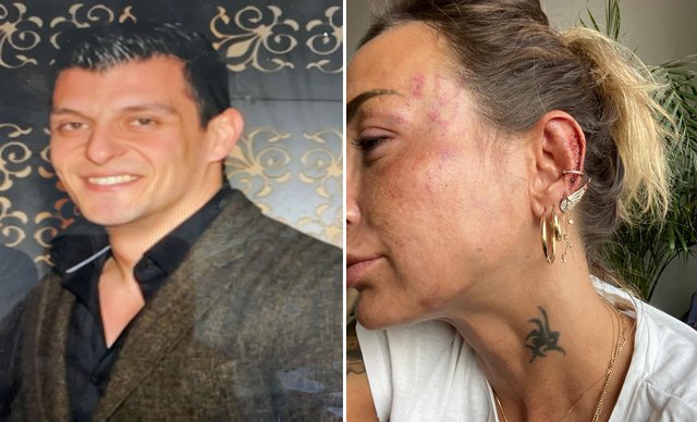 Uzaklaştırma kararına rağmen eski sevgilisini darp etti: Tutuklandı