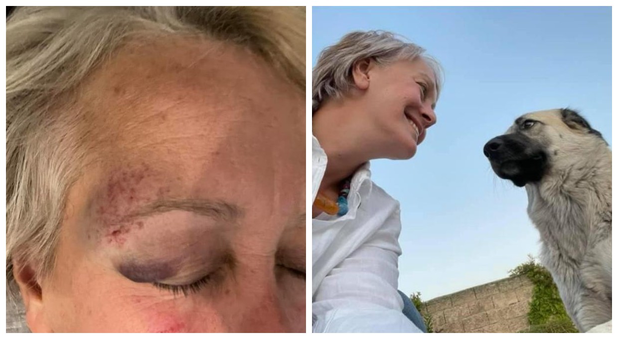 Göbeklitepe'de 20 yıl kazı başkanlığı yapan Alman arkeoloğun eşinden darp iddiası