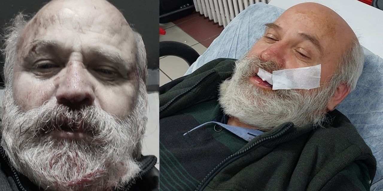 Hürriyetçi Eğitim-Sen'in bir yöneticisi daha saldırıya uğradı