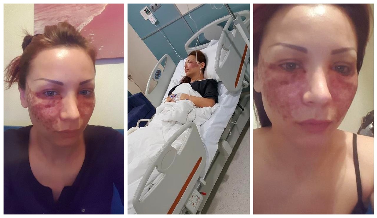 Bulgar modelin estetik kabusu... Kuaför kardeşler: Örümcek ağı yapmadık, iftira