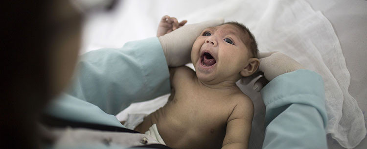 Zika virüsü nedir?