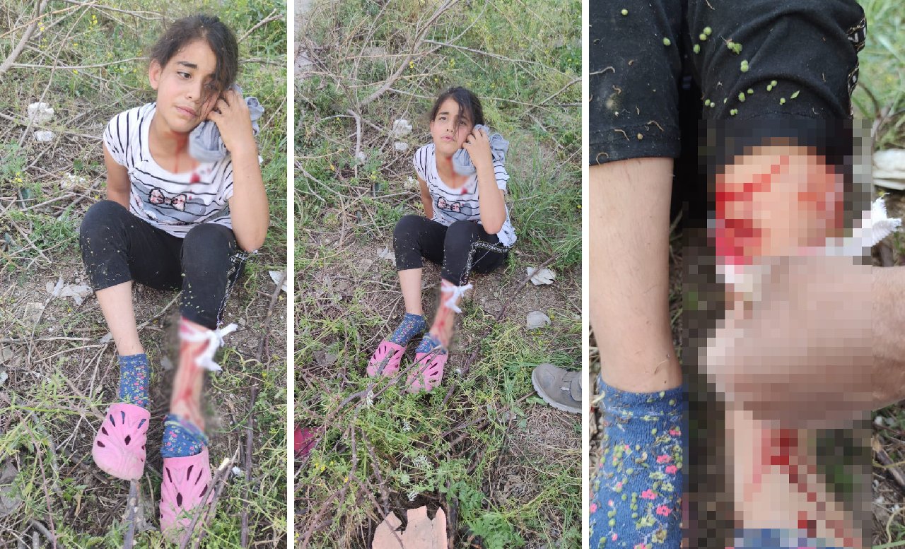 4 köpek küçük kıza saldırdı