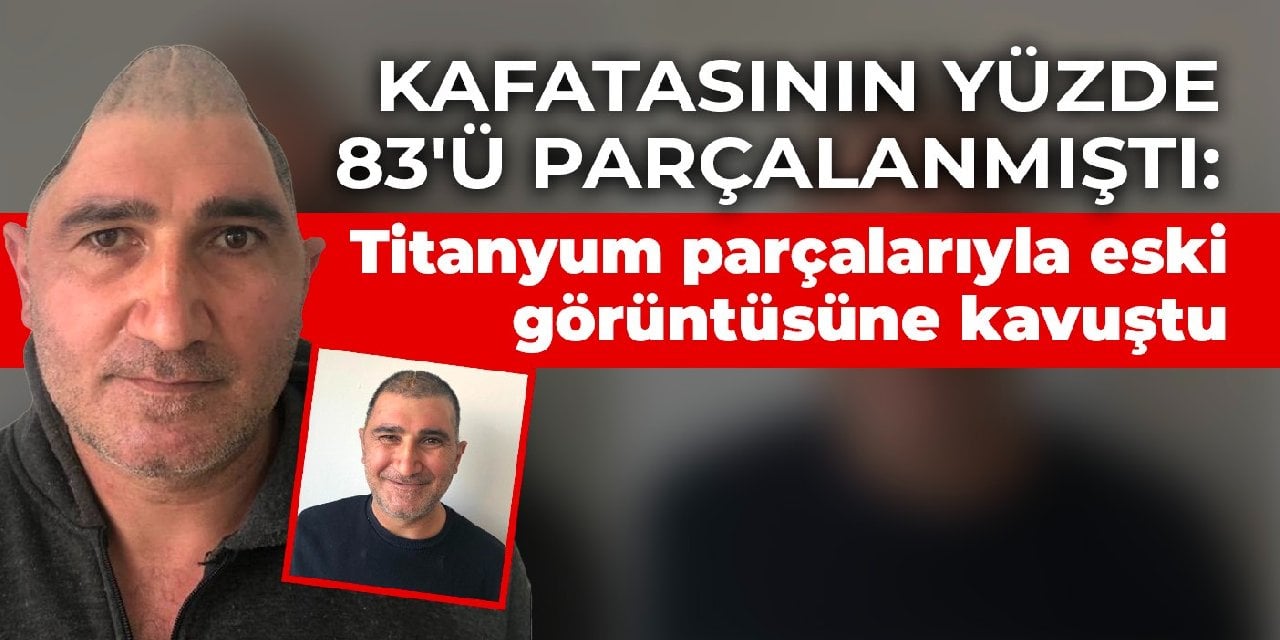 Kafatasının yüzde 83'ü parçalanmıştı: Titanyum parçalarıyla eski görüntüsüne kavuştu