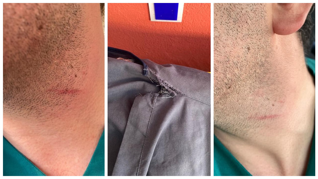 Hasta yakını, 'adli vaka' girişi yapan doktoru darbetti