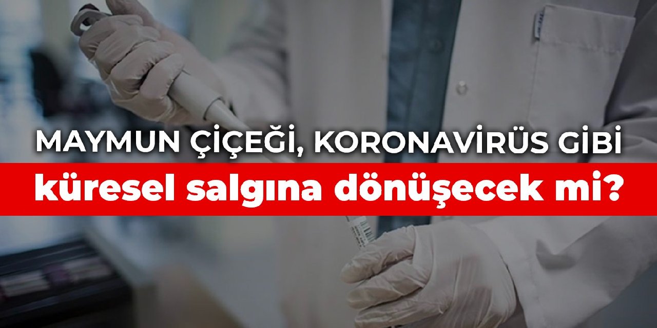 Maymun çiçeği, koronavirüs gibi küresel salgına dönüşecek mi?