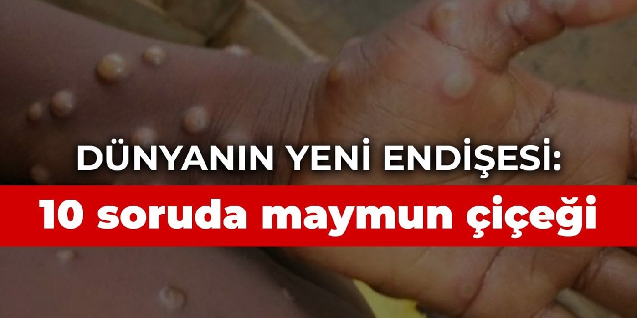 Dünyanın yeni endişesi: 10 soruda maymun çiçeği