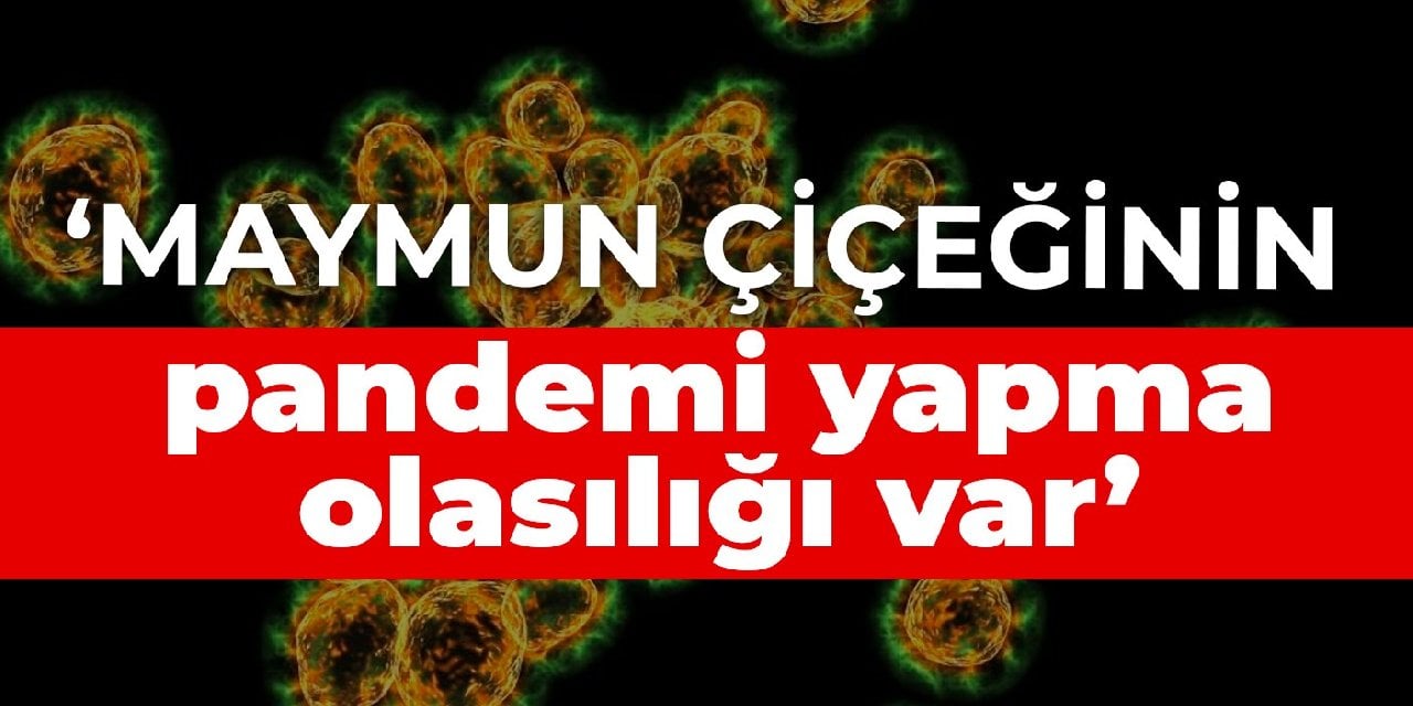 Prof. Azap: Maymun çiçeğinin pandemi yapma olasılığı var