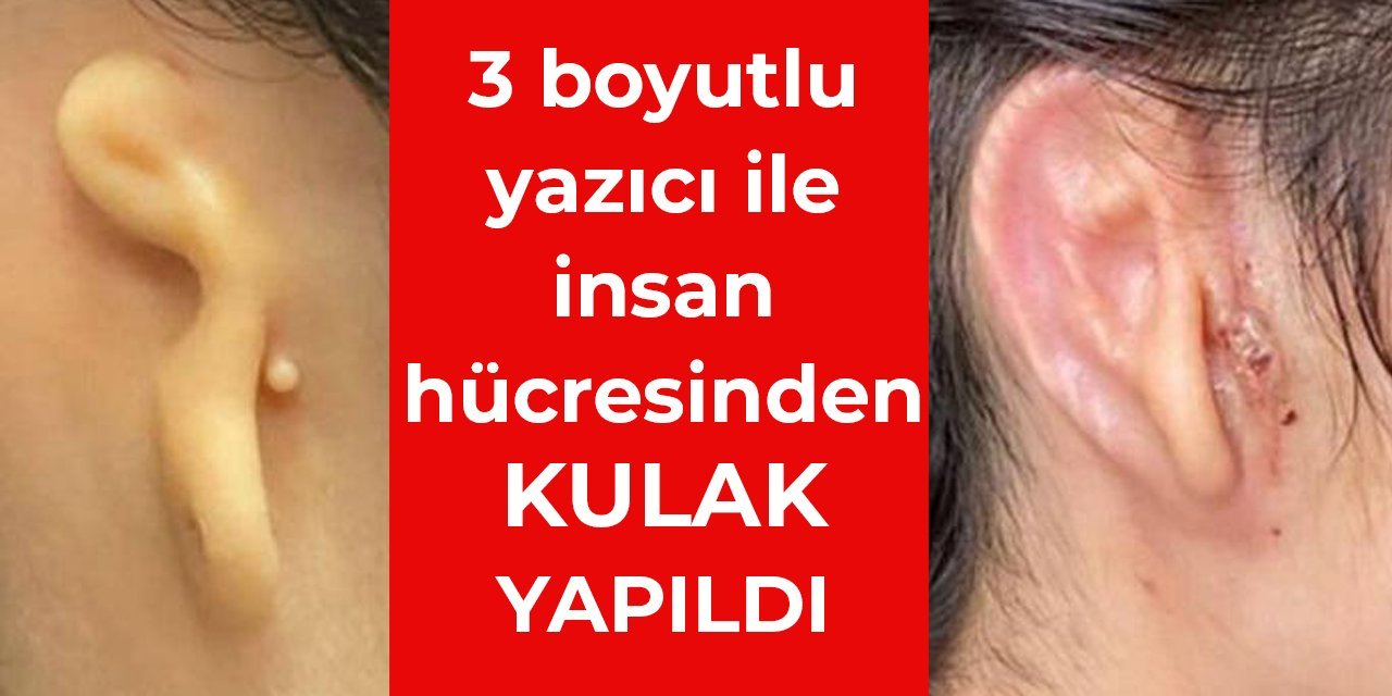 3 boyutlu yazıcı ile insan hücresinden kulak yapıldı