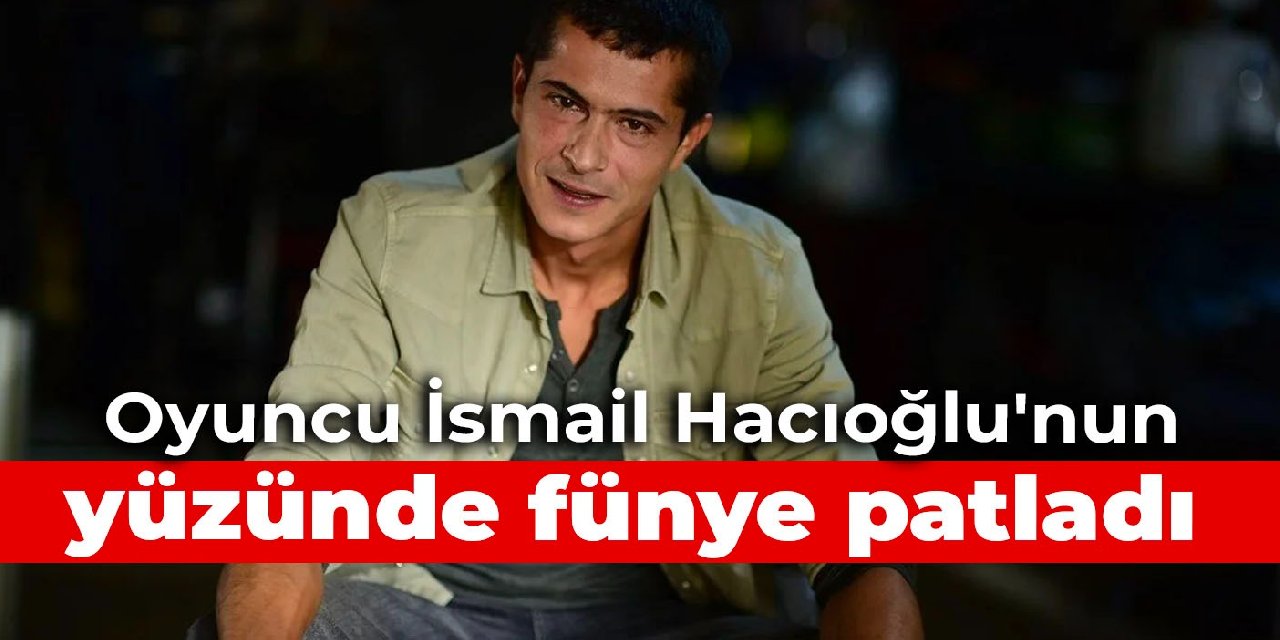 Sette kaza: Oyuncu İsmail Hacıoğlu'nun yüzünde fünye patladı