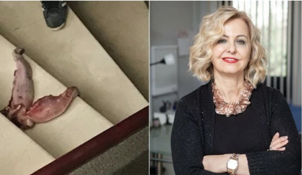 Prof. Esin Şenol'u tehdit eden zanlının ifadesi ortaya çıktı