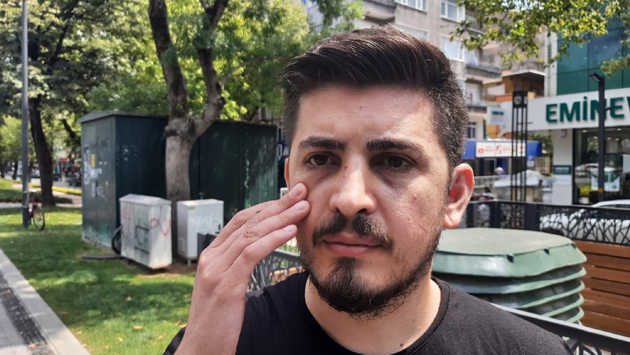 Hemşirenin burnunu kırmıştı: 2 kez serbest bırakıldıktan sonra tutuklandı