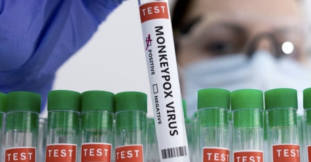 DSÖ: Maymun çiçeği vakalarının yayılımı hızlandı