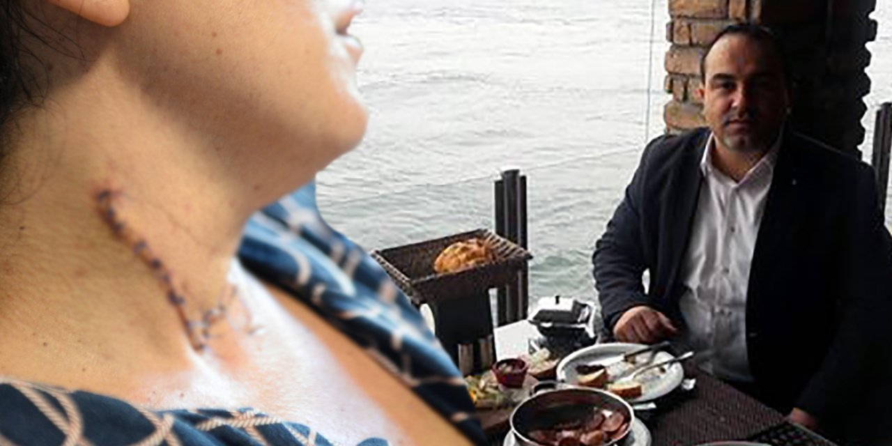 Erkek şiddeti bitmiyor: Ayrıldığı kadının boğazını ve karnını kesti