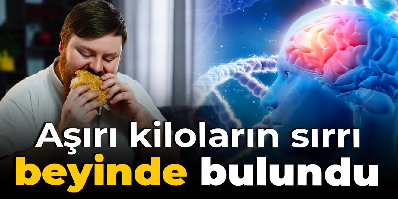 Aşırı kiloların sırrı beyinde bulundu