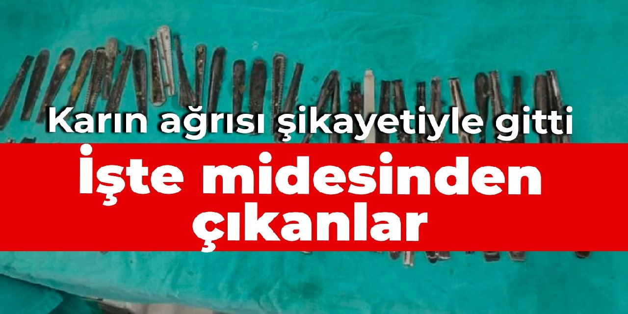 Karın ağrısı şikayetiyle gitti: İşte midesinden çıkanlar