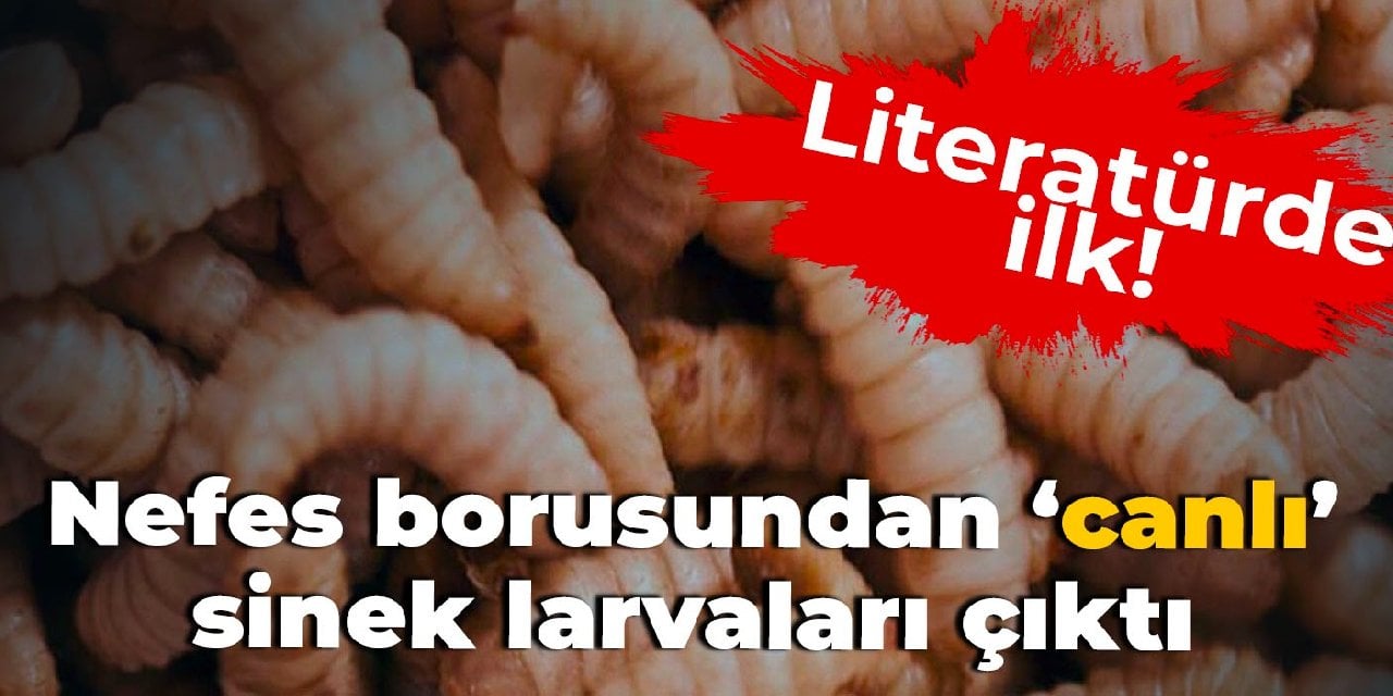 Nefes borusundan canlı sinek larvaları çıktı