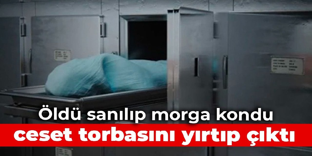 Öldü sanılıp morga kondu, ceset torbasını yırtıp çıktı