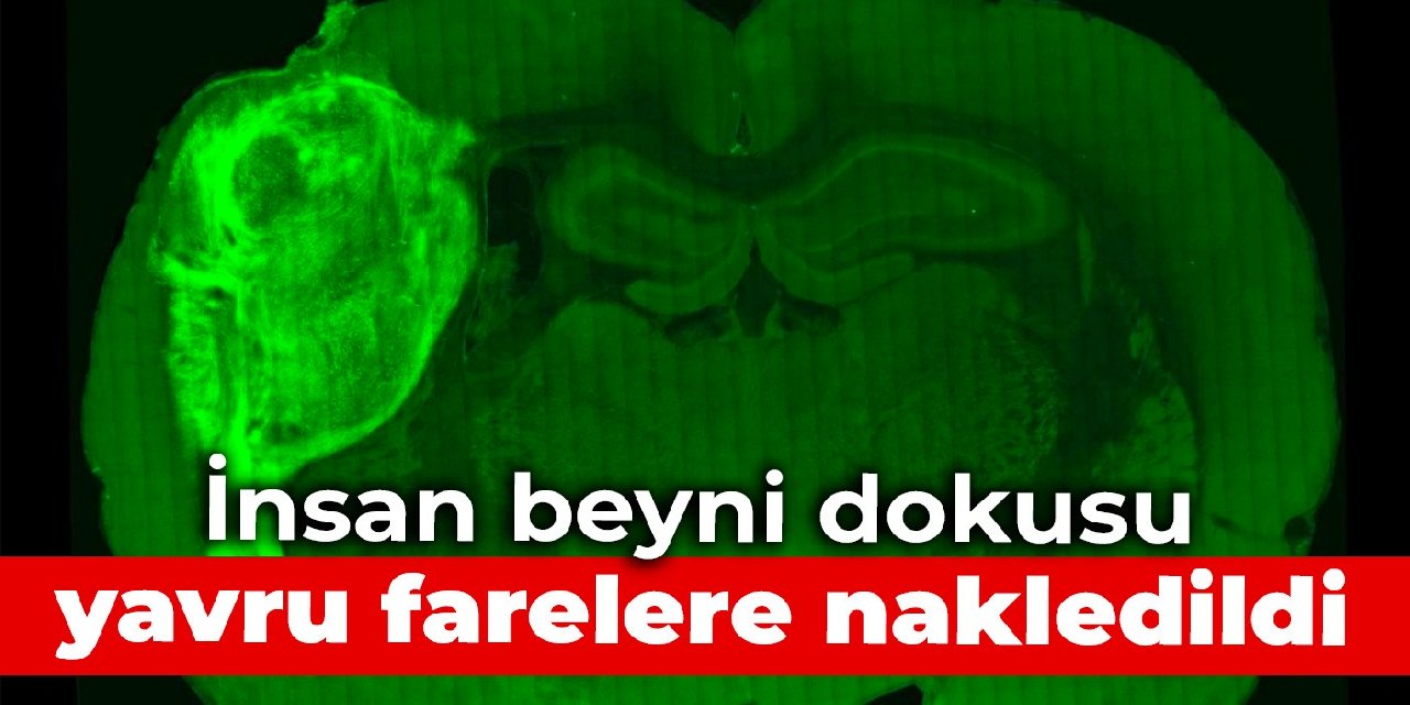 İnsan beyni dokusu, yavru farelere nakledildi