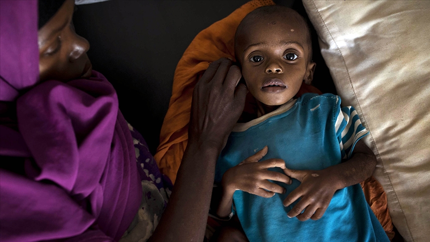 Oxfam: Her 36 saniyede bir kişi açlıktan ölebilir