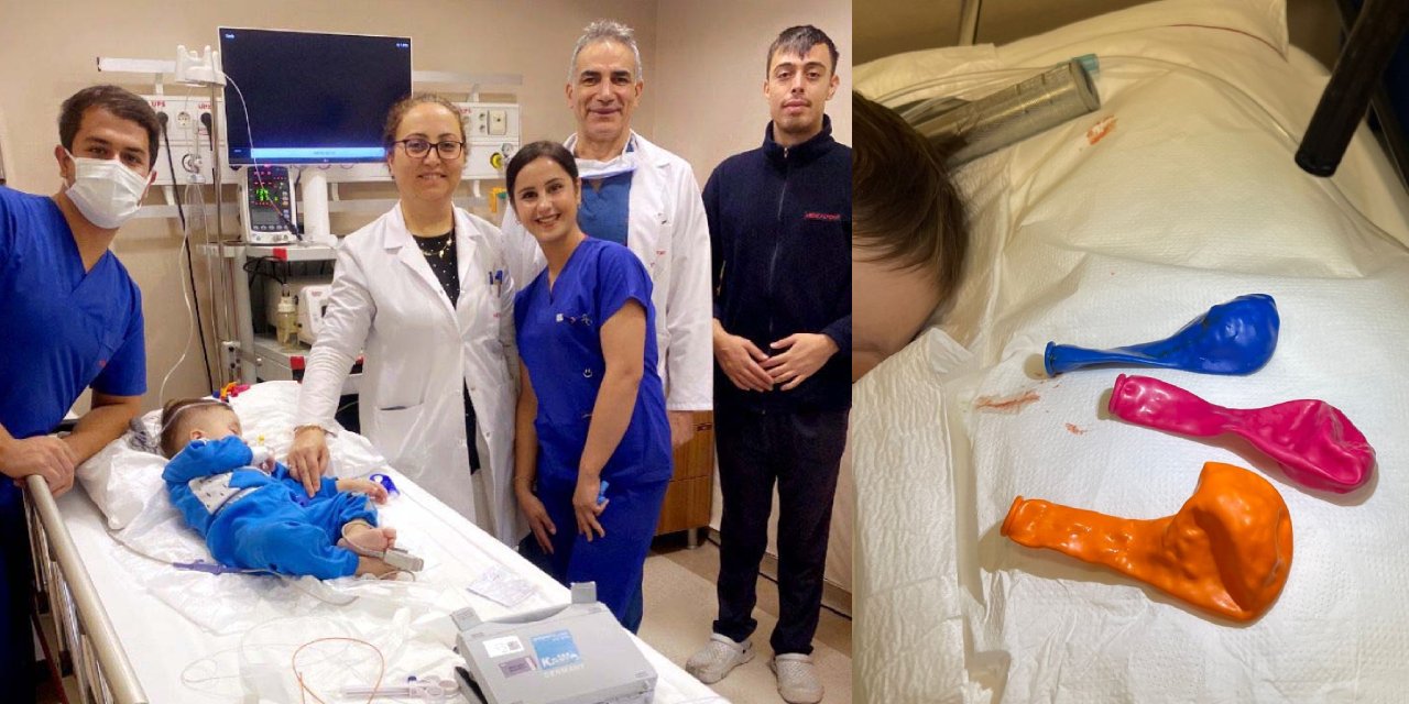 Bebeğin midesinden 3 balon çıktı