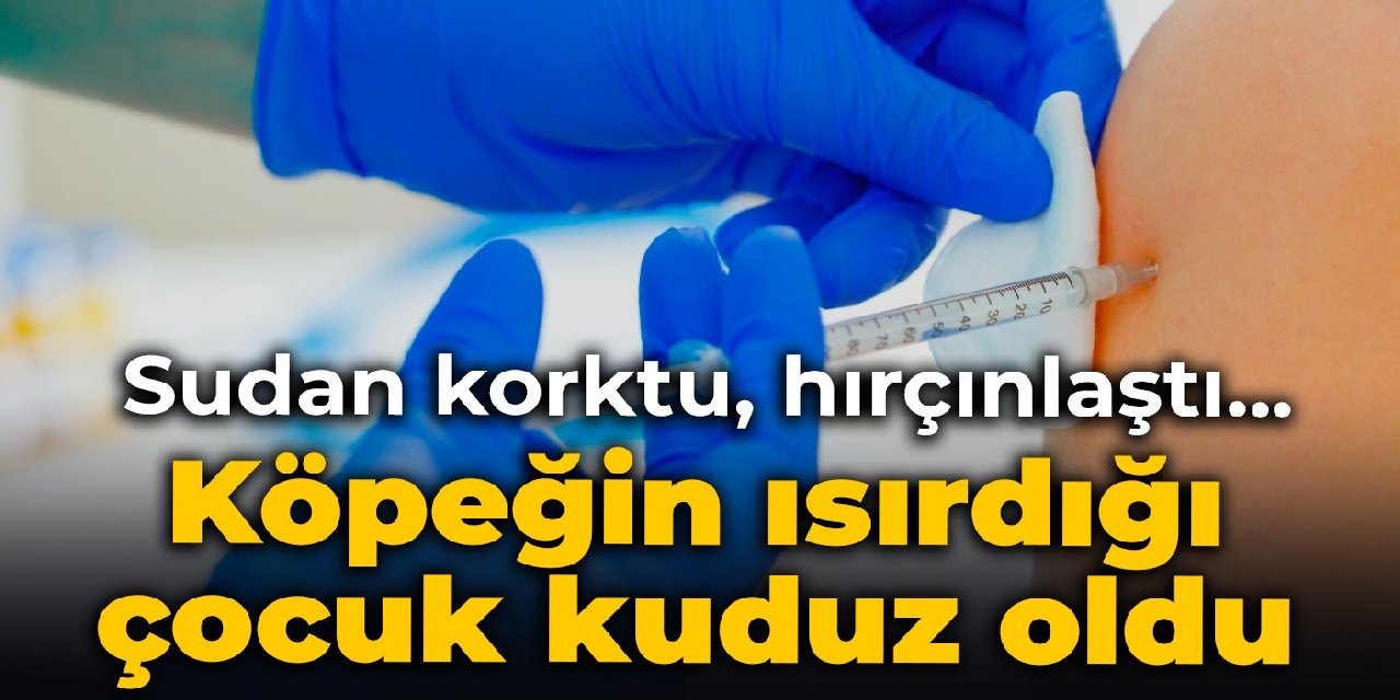 Köpeğin ısırdığı çocuk kuduz oldu: Sudan korktu, hırçınlaştı...