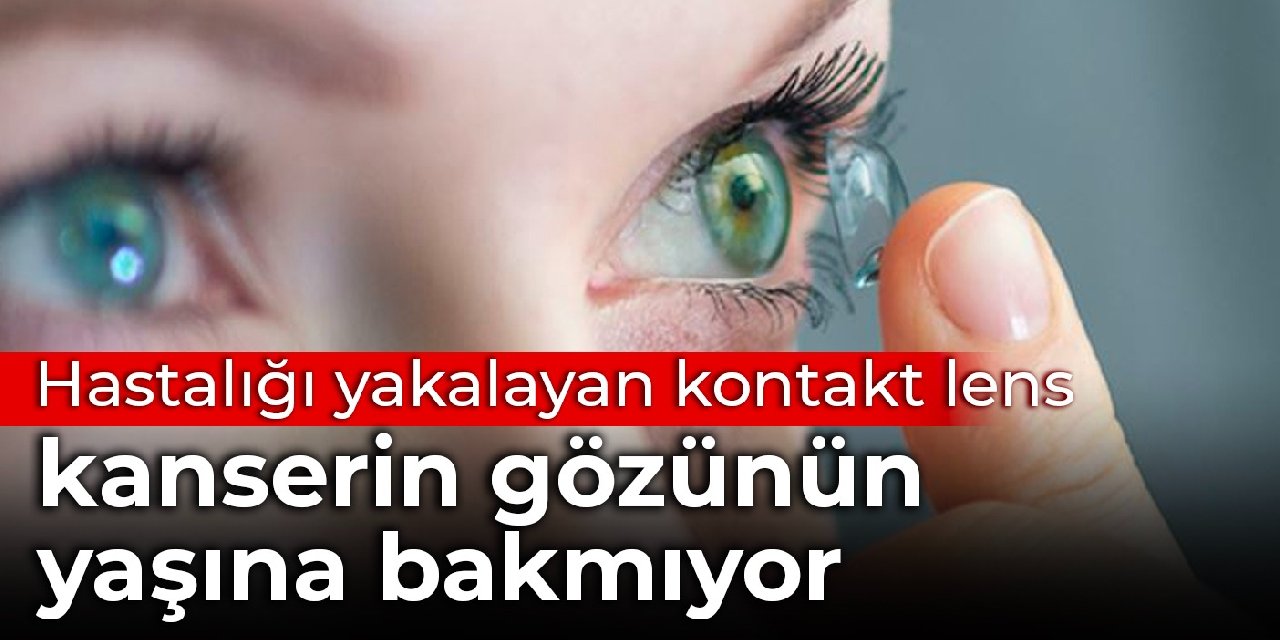 Bilim insanları hastalığı yakalayan kontakt lens geliştirdi: Kanserin gözünün yaşına bakmıyor