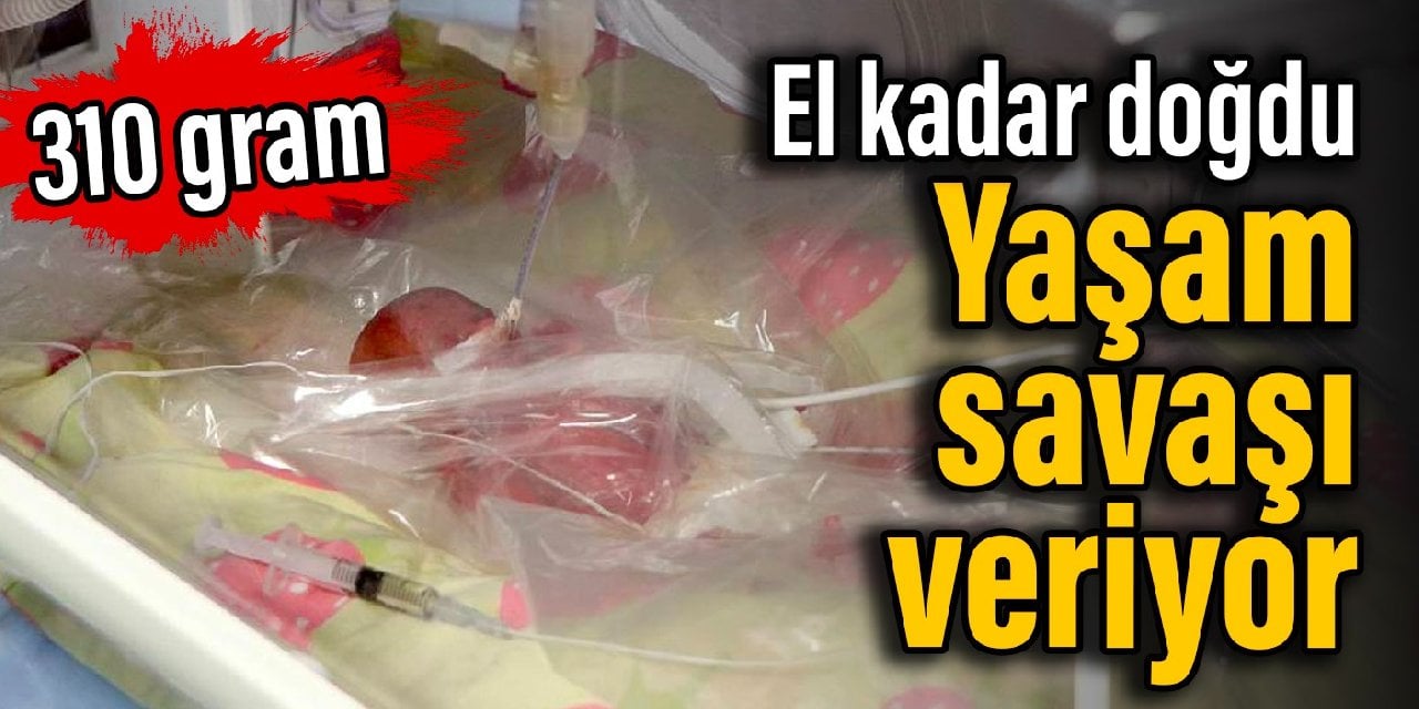 El kadar doğdu: Yaşam savaşı veriyor