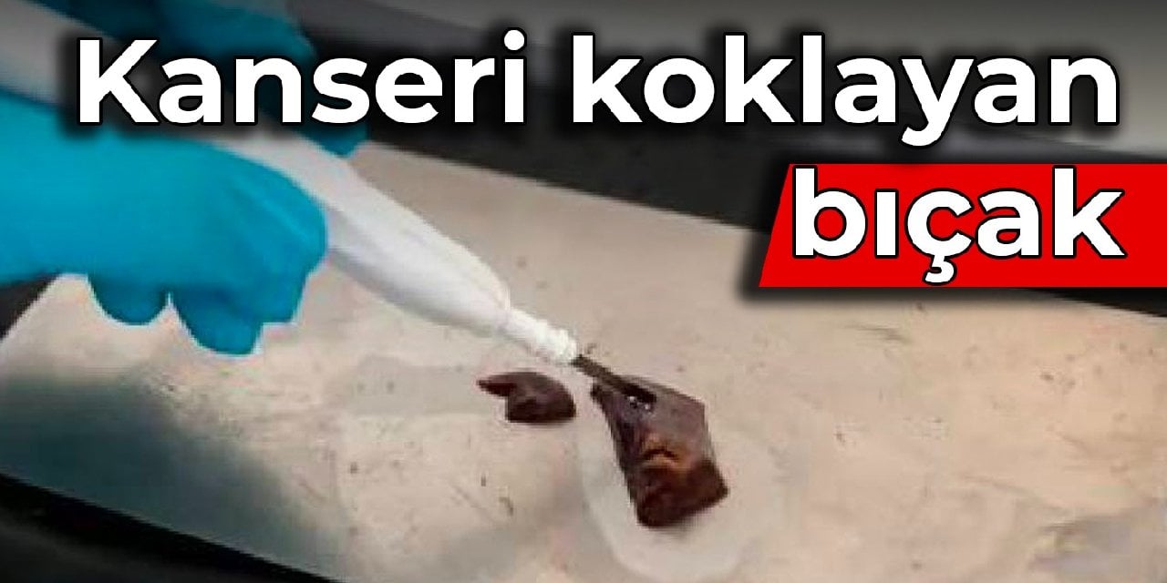 Kanseri koklayan bıçak