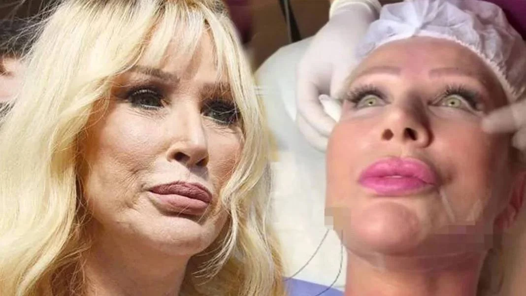 "Artık yeter" Öyle bir yerine estetik yaptırdı ki... Hayranları Seda Sayan'a isyan etti