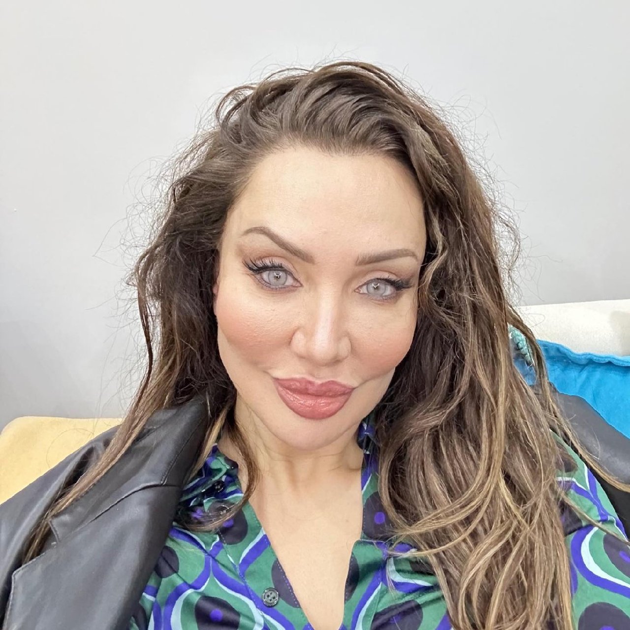 Tanımak imkansız.  Estetiğin dozunu kaçıran 49 yaşındaki Umut Akyürek 'in son haline bakın. Buna gerek var mıydı?