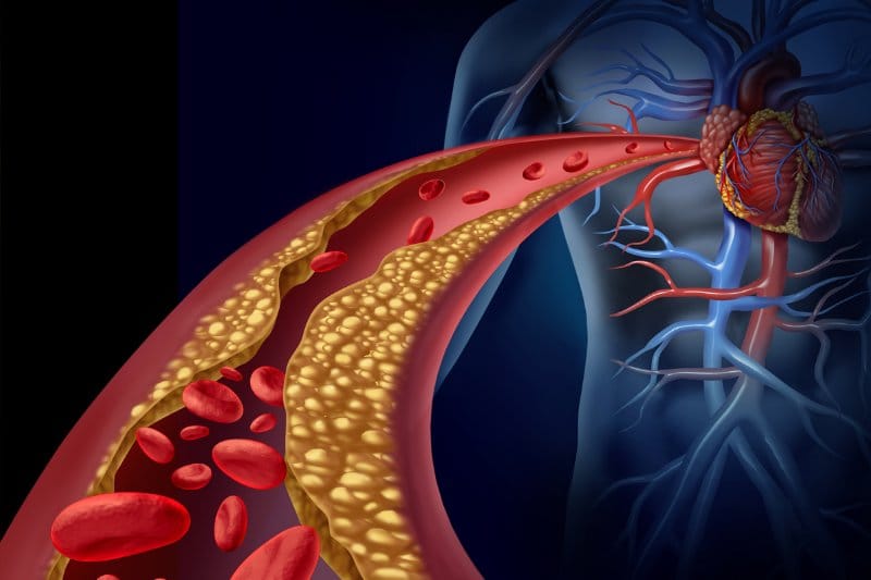 Ünlü kardiyologtan açıklama: Yüksek tansiyonu düşürmek için lütfen ilaç kullanmayın. Bundan bu çare almak daha iyidir…