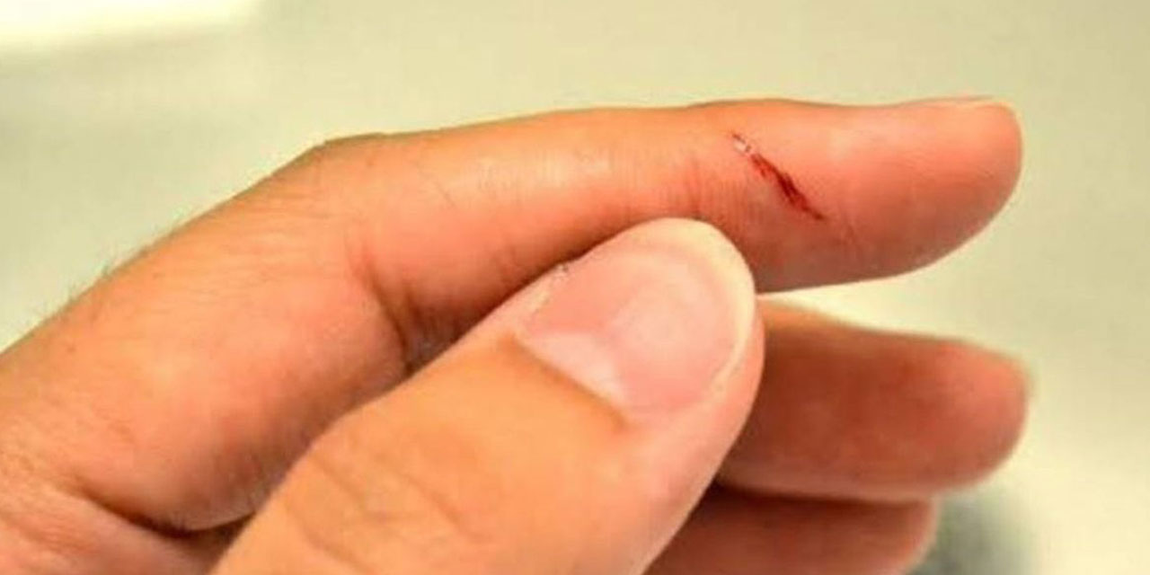 Kağıt kesiği neden çok acır? Uzmanlar araştırdı... Sonuçlar sizi çok şaşırtacak