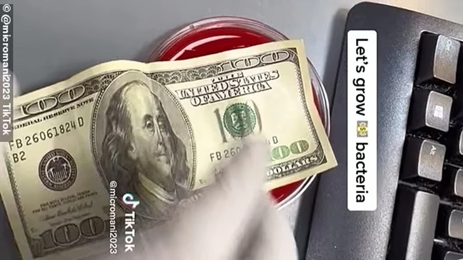 Paranın üzerinde neler yaşıyor neler... Bir bilim insanı görüntüledi Bu paranın temizlenmesi şart...