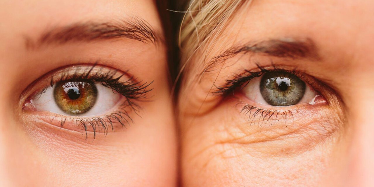 Gözaltı kırışıklıkları için ev yapımı maske önerisi