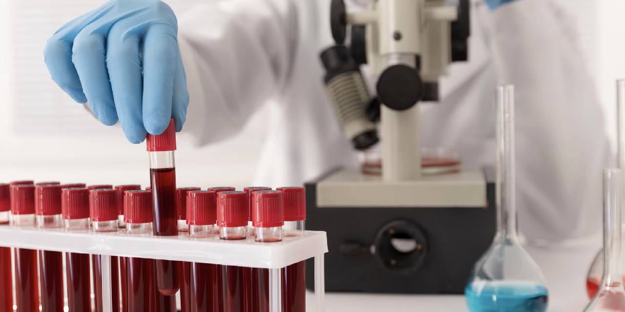 Kan grubu testi: En zeki kan grubu hangisi? Bu kan grubuna sahipseniz kişilik özellikleriniz...