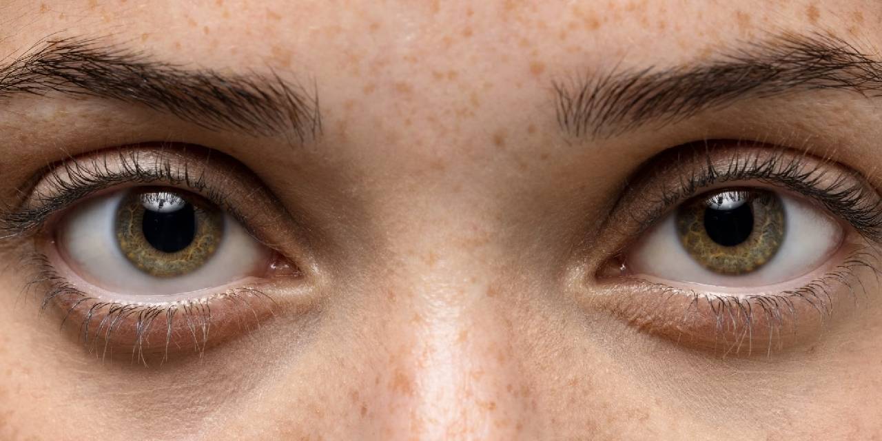 Göz altı morluklarıyla mücadelede en etkili 6 yöntemi açıklıyoruz. Düzenli kullanımda tamamen bembeyaz göz altlarınız olacak!