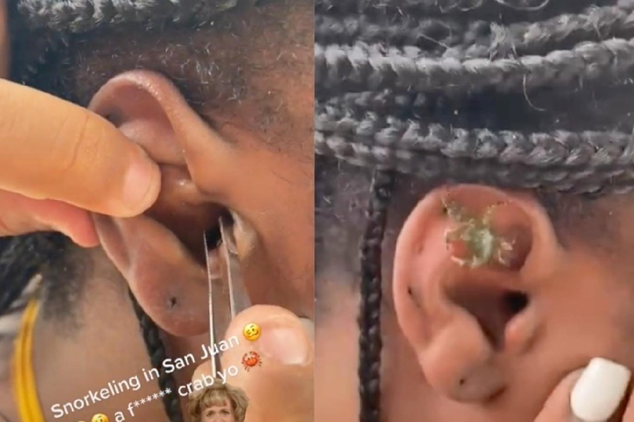 Kulağından yengeç çıkan kadının TikTok videosunu izleyenler dehşete düştü