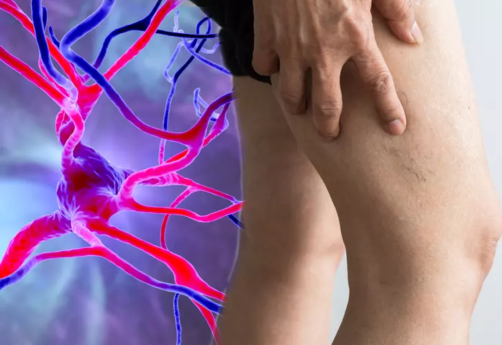 Felç geçirmeden aylar önce ortaya çıkan belirti! Bu semptomu fark etmek hayatınızı kurtarabilir…