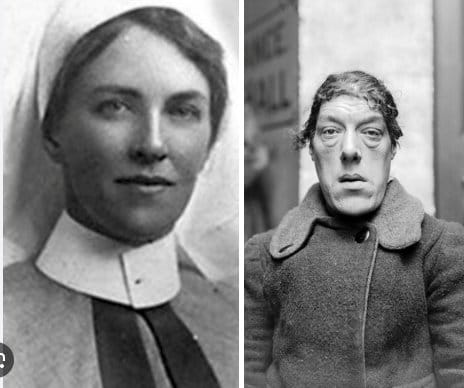 Çocuklarına bakabilmek için 'dünyanın en çirkin kadını' unvanını alan annenin yürek burkan hikayesi