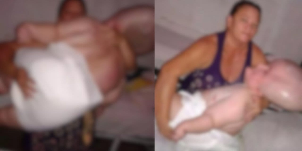 Dünya bu bebeği konuşuyor! Kafasının büyümesi durdurulamayan bebek yaşam mücadelesi veriyor...